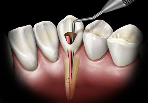 20afdaa2cef0cf3642115b985fce27da-dental-images-health-education
