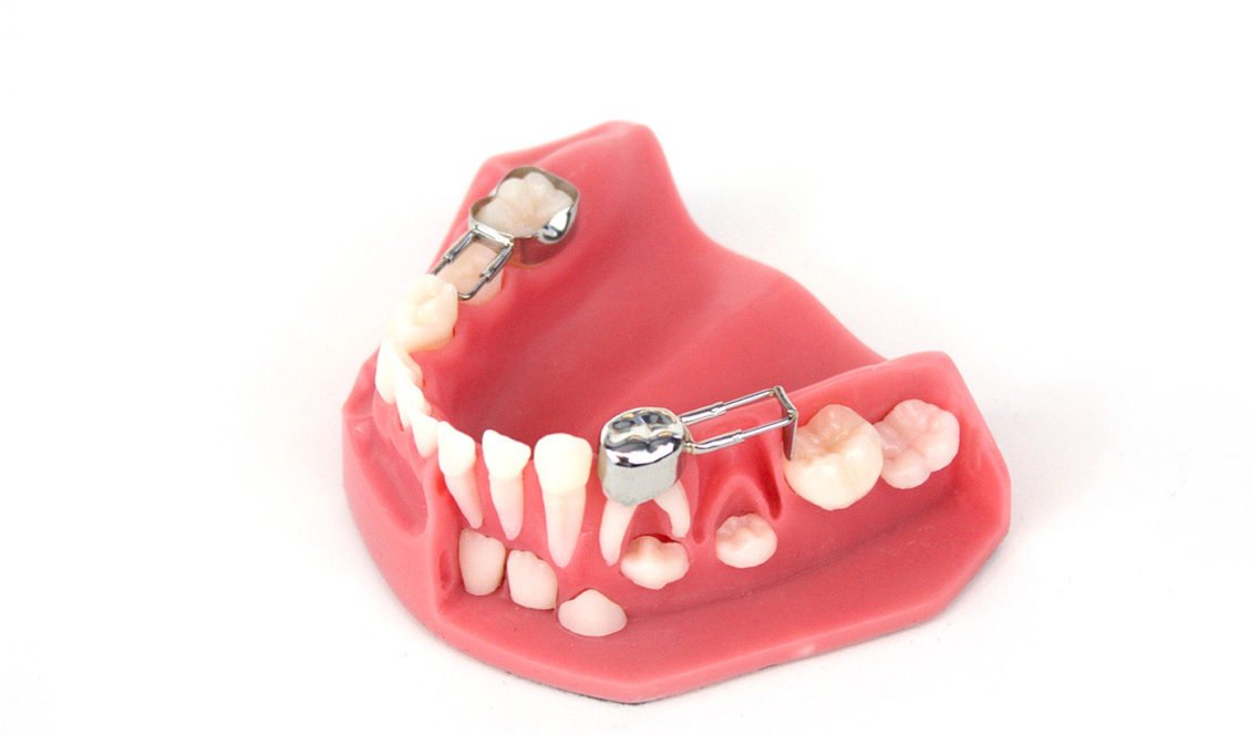 620-100_S_MouthModel_2-1130x664