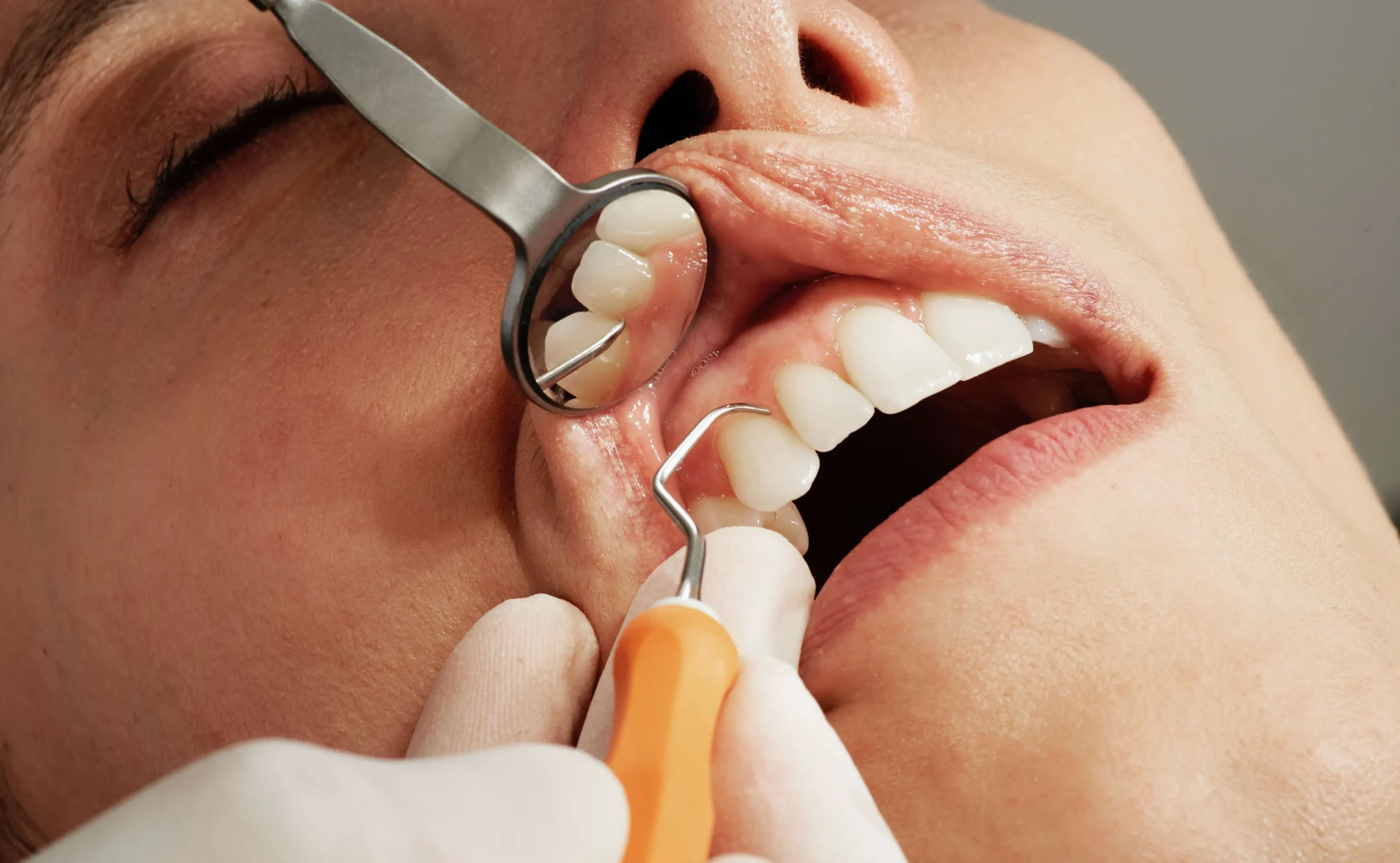 Dental-patient-having-their-first-dental-checkup-e1697296186316