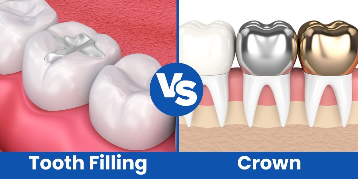 Tooth-Filling